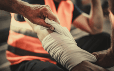 Suffering From a Burn Injury at Work in South Carolina? (Here’s What to Do)