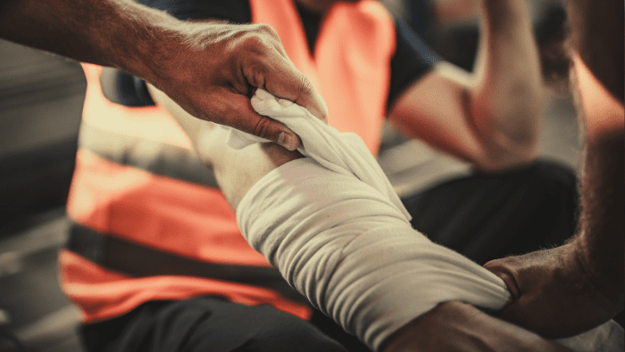 suffering from burn injury at work in South Carolina - what to do
